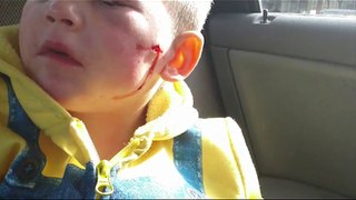 3 year old boy attacked by pitbull