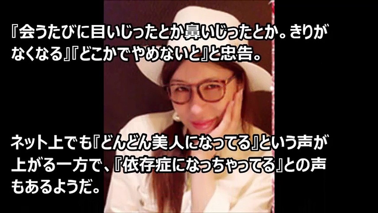 整形やりすぎで怖すぎる芸能人たち。KABA.ちゃん、水沢アリー、ヴァニラ【芸能おもクロ秘話ニュース】