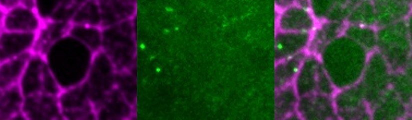 Combined Stacks Cdep