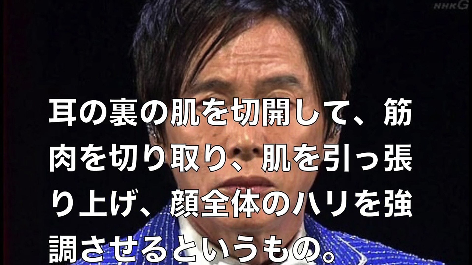 衝撃悲報 森進一 顔劣化が止まらない 原因は年齢では無い 不自然な笑顔にドン引きwww Video Dailymotion