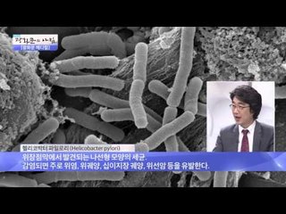 '헬리코박터' 젊은 세대에 더 위험하다? [광화문의 아침] 73회 20150917