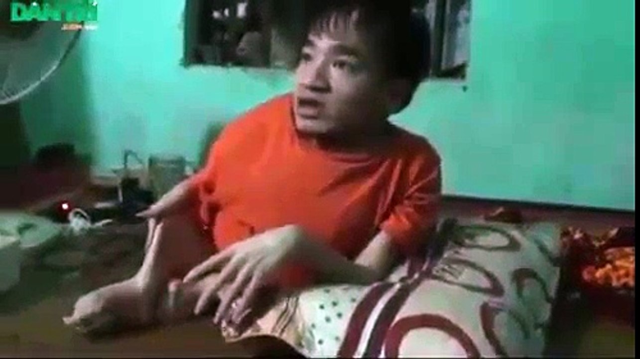 Chàng trai khuyết tật trải lòng khi kiện bố đẻ của mình