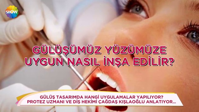 Gülüş Tasarımı ile Özgürce Gülmek Sizinde Hakkınız!