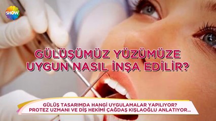 Gülüş Tasarımı ile Özgürce Gülmek Sizinde Hakkınız!