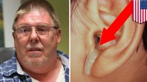 Man finds wakes to find brain juice  leaking out of his ear