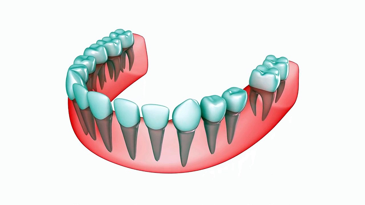 Replace Your Missing Teeth with Dental Implant Treatment | GB Dental