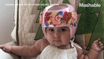 Painter turns baby's medical helmets into precious art