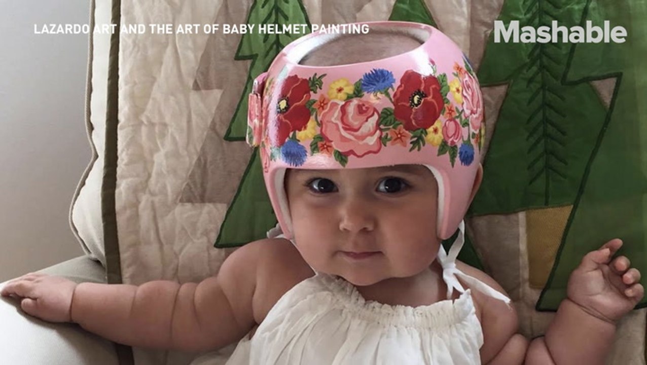 Painter turns baby's medical helmets into preci...