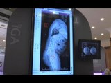 Napoli - Chirurgia vertebrale, esperti a confronto su nuove tecniche hi-tech (17.05.17)