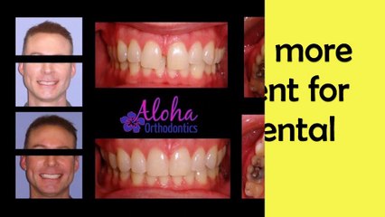 Affordable Braces Near Me