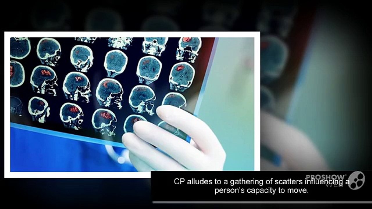 Cerebral Palsy Treatment