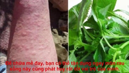 4 loại lá trị nổi mề đay dứt điểm mà bạn cần biết