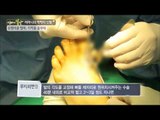 솟탱이골 엄마의 수술시작 [엄마의 봄날] 11회 20150815