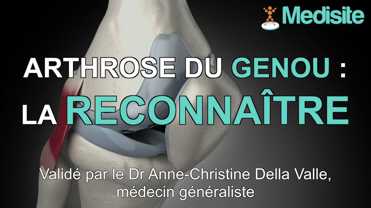 Reconnaître une arthrose du genou