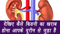 Symptoms of Liver fails | किडनी की दिक्कत आपके यूरीन से जुड़ी है | Boldsky