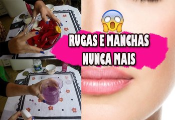 Download Video: Basta uma aplicação para acabar com rugas e manchas - Resultado 100% Garantido! Mascara de Rosas