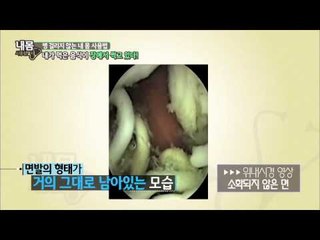 급하게 먹으면 장에서 음식이 썩고 있다? [내몸사용설명서] 41회 20150312