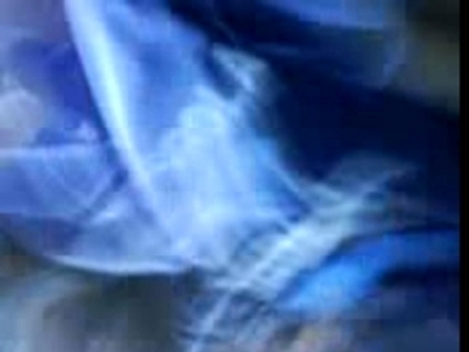 Bordeaux vs lyon 2007/2008