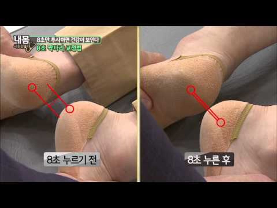8초 짝다리 교정법 [내 몸 사용 설명서] 50회 20150516