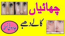How To Remove Dark Spots On Face Fast || Remove Freckles Tips In Hindi | Urdu