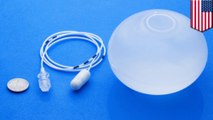 Gastric balloon could help weight-loss without surgery
