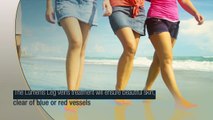 Lumenis Leg Veins Treatment
