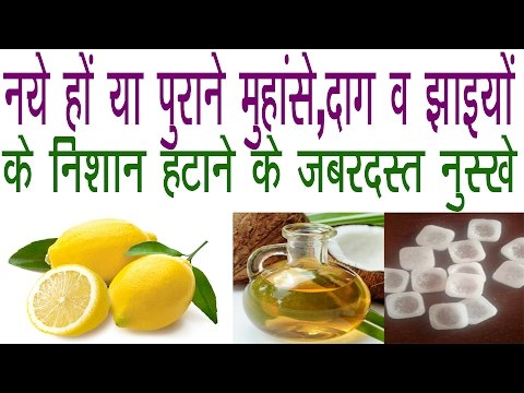 How To Remove Pimples,Black Spot,Wrinkles And Marks |मुँहासे,दाग धब्बे व झाइयां हटाने के अचूक नुस्खे