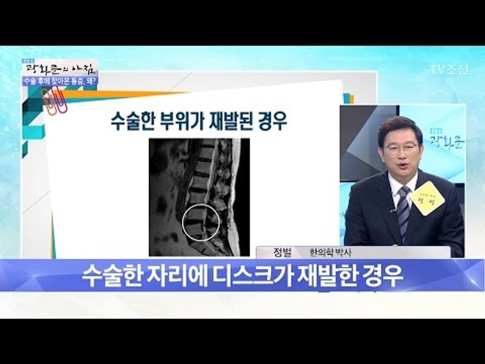 디스크 수술 후에도 통증이 온다?! [광화문의 아침] 486회 20170523