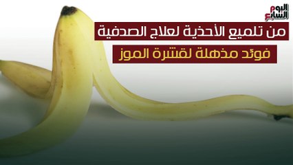 فيديو معلوماتى.. من تلميع الأحذية لعلاج الصدفية.. فوائد مذهلة لقشرة الموز