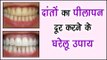 दांतों का पीलापन दूर करने के घरेलू उपाय || Natural Teeth Whitening Treatment || Arogya India
