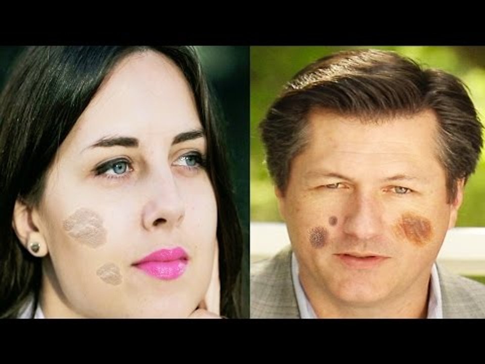चेहरे के काले दाग धब्बे हटाएँ | Special Remedies For Dark Spot on Face | Subtitles English