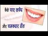 कैसे पाए सफेद और चमकदार दाँत || Get Shiny White Teeth || Health Tips By Shristi