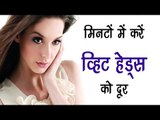 मिनटों में करें व्हिट हेड्स को दूर || White Heads Removal Tips In Hindi || Health Tips By Shristi