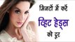 मिनटों में करें व्हिट हेड्स को दूर || White Heads Removal Tips In Hindi || Health Tips By Shristi