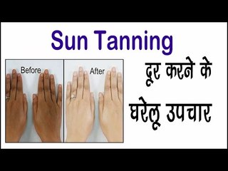Sun Tanning दूर करने के घरेलू उपचार || How To Remove Sun Tan Instantly || Arogya India