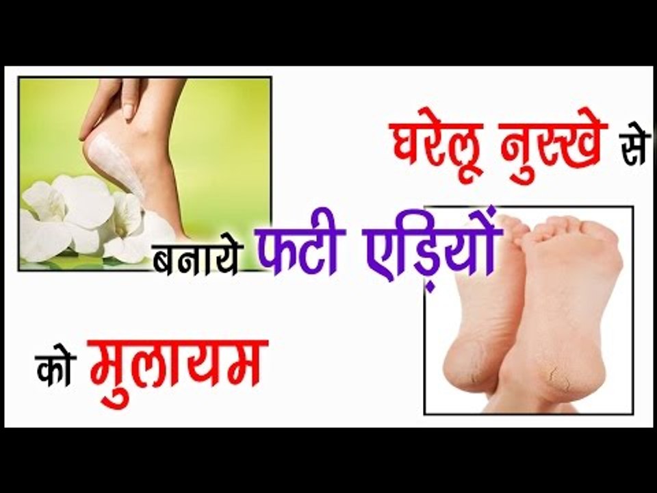 घरेलू नुस्खे से बनाये फटी एड़ियों को मुलायम || Crack Heel Treatment || Health Tips By Shristi