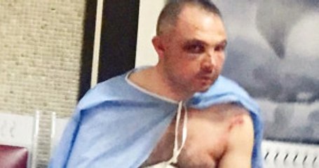 Genelkurmay Başkanı'nın Darbe Gecesi Dayak Yiyen Emir Subayı 10 Ay Sonra Görüntülendi