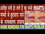 मस्सों को हटाने के रामबाण उपाय | Warts Removal Home Remedies | Masso Ka Gharelu Ilaj