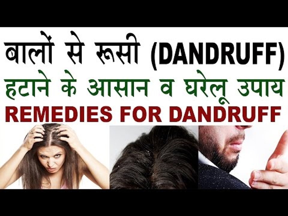बालों की रुसी (Dandruff) दूर करने के घरेलु उपाय | How To Remove Dandruff In Hindi | Rusi Se chutkara