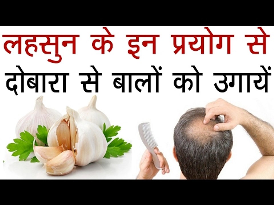 दोबारा से बालों को उगायें,गंजेपन का रामबाण इलाज लहसुन से | Grow Your Hair With Garlic In Hindi