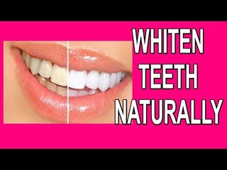 How To Get Whiten Teeth Faster|सफ़ेद दांतों के लिए आसान उपाय|chamakata danton ke liya upaya