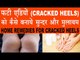 फटी एड़ियां (CRACKED HEELS) को कैसे बनायें मुलायम | Home Remedies For Cracked Heels In Hindi