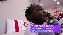 Previously conjoined sisters are now able to walk-DY