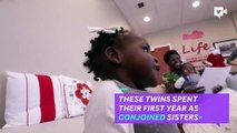 Previously conjoined sisters are now able to