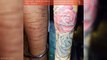 40 most Amazing Tattoos That Turn Scars Into Works Of Art