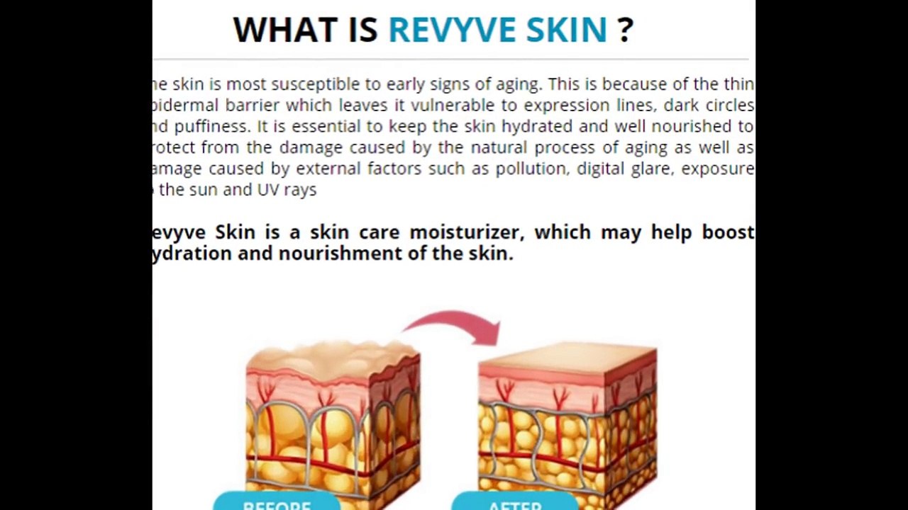Revyve