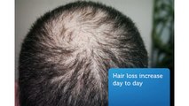 Hair Fall Stem Cell Therapy Treatment in Hyderabad @ Teja's