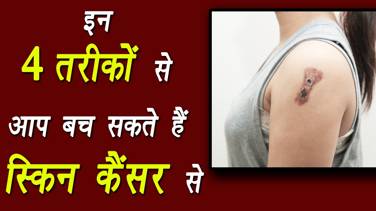 4 ways to prevent skin cancer | स्किन कैंसर से बचने के ये 4 घरेलू उपाय | Boldsky