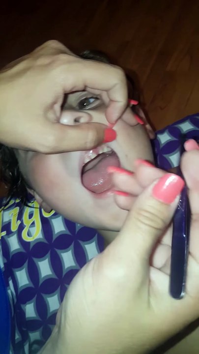 Nail Biting Video