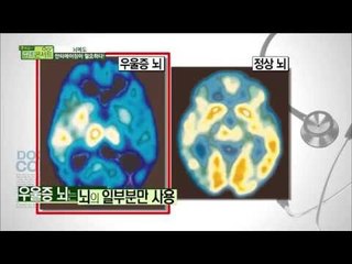 뇌를 늙지 않게 하는 방법 기본수칙 대공개 [닥터콘서트62회]